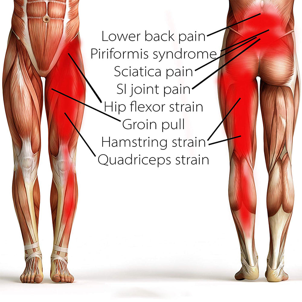 How to Relieve Sciatic Nerve Pain