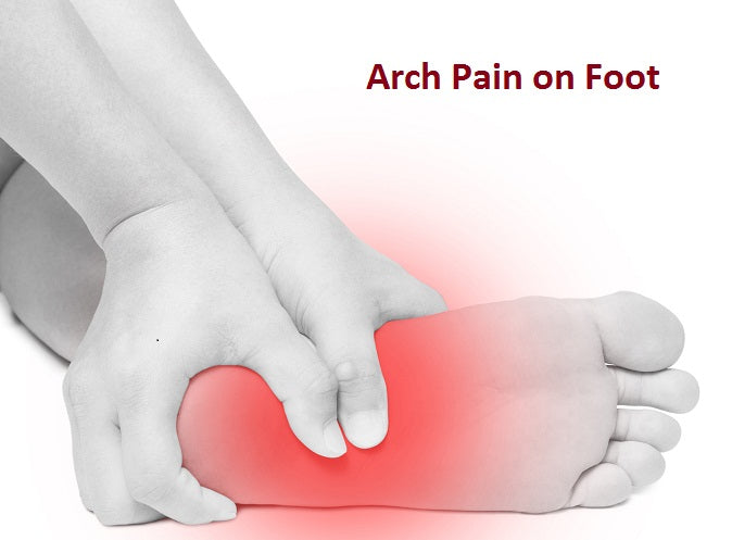 How to Prevent and Treat Foot Arch Pain