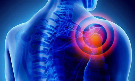 How to Relieve Shoulder Pain