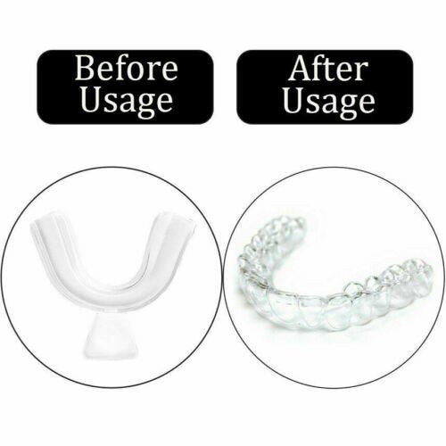 4Pcs Mouth Guard Teeth Whitening Thermoforming Tooth Trays Molding Bleaching