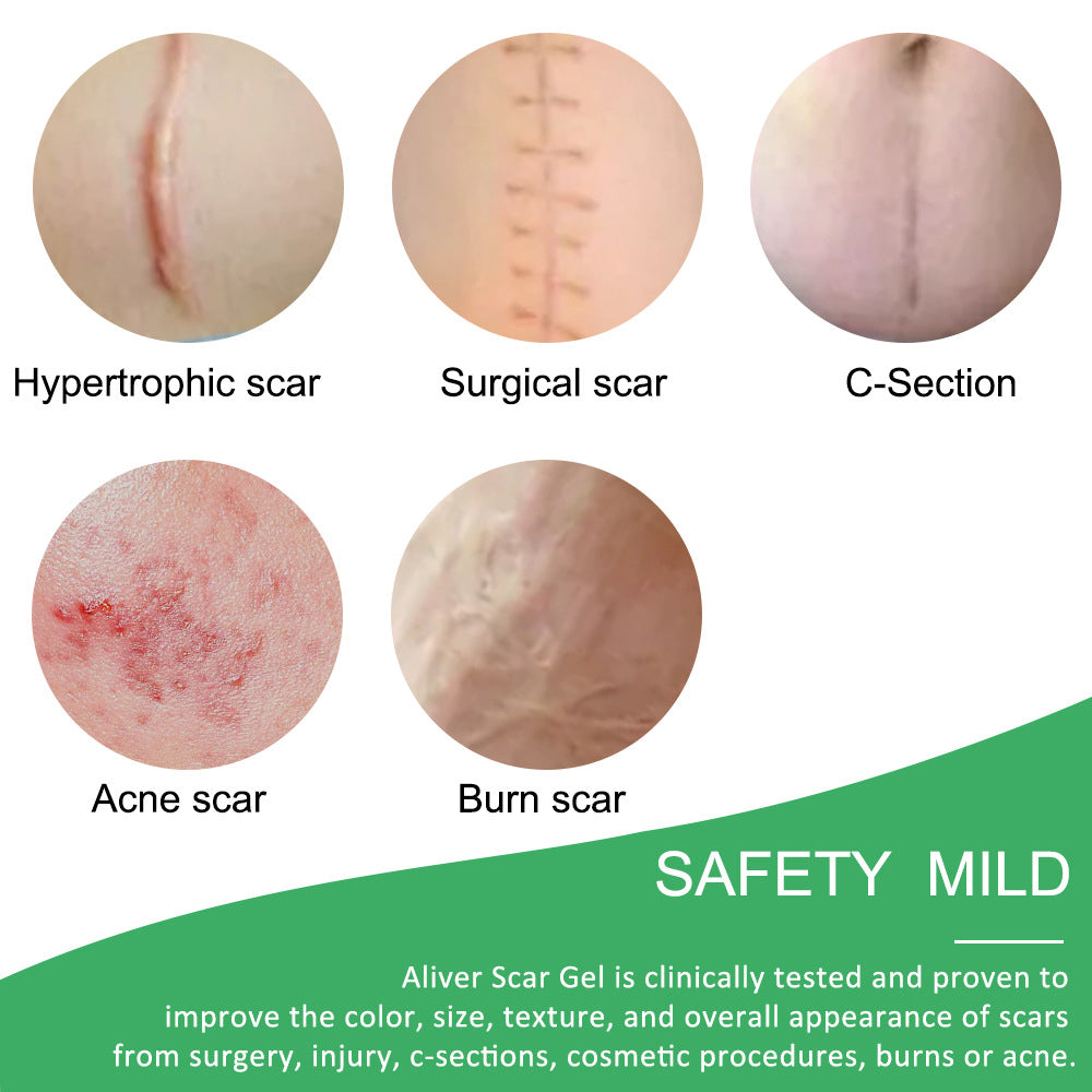 Reusable and Washable Silicone Scar Sheets to Remove Multiple Scars